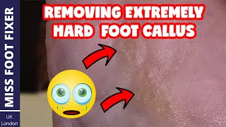 REMOVING EXTREMELY HARD FOOT CALLUS amp TINY CORN REMOVAL 2022 BY MISS FOOT FIXER [upl. by Yriek879]