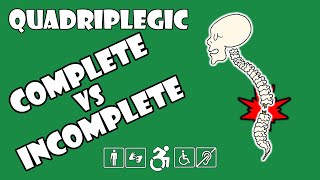 Complete vs Incomplete Spinal Cord Injury Explained  Quadriplegic C5C6C7 [upl. by Chloe]