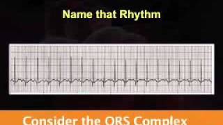 Introduction to EKG Rhythm Interpretation Part 2 [upl. by Sassan]