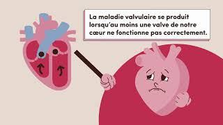 Semaine de sensibilisation aux maladies valvulaires 2024 [upl. by Howard]