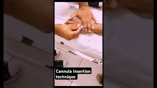 IV Cannula Insertion how To Insert IV Cannula doctor mbbs youtubeshorts ytshorts neet viral [upl. by Lazar796]