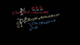 Nerve Root vs Peripheral Nerve 2 of 2 motor complaints upper extremity [upl. by Esilahc503]