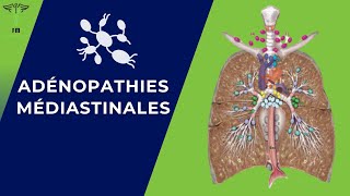 Adénopathies Médiastinales Rappel Anatomique  Diagnostique Positif  Etiologies  Traitement [upl. by Cline]