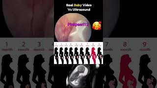 Baby movement in moms womb ♥️🥰shortvideo movement pregnancy baby [upl. by Hestia]