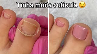 Transformação nas unhas dos pés  Cutícula e esmaltação [upl. by Lleret]