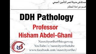 DDH Pathology ProfHisham AbdelGhani nasrcity covid19 online lectures 2020 [upl. by Ycnaffit513]