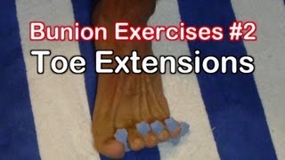 Bunion Exercises 2 Toe Extension Exercise for Bunions [upl. by Itsirc]