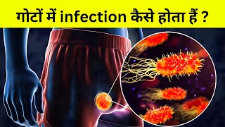 मर्द हो तो ज़रूर देखना  मर्दों के गोटों में infection [upl. by Kinimod509]