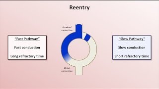 Intro to EKG Interpretation  Mechanisms of Tachyarrhythmias [upl. by Leirbaj]