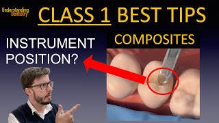 Class 1 Composite Restoration Lecture Occlusal restoration molars and premolars dental filling [upl. by Hsepid96]