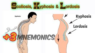 Lordosis Kyphosis and Scoliosis [upl. by Keven]