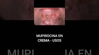 MUPIROCINA EN CREMA  USOS [upl. by Melloney]