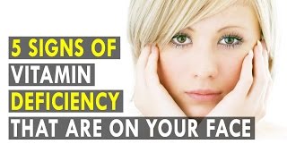 5 Signs of Vitamin Deficiency That Are Literally Written On Your Face  Health Sutra [upl. by Chang]