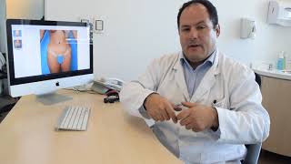 ¿Cuánto demora la recuperación de una abdominoplastia [upl. by Oramug]