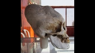 Newly Discovered Elongated Skulls In Paracas Peru [upl. by Rieger]