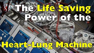 How Does the HeartLung Machine Work to Save Lives [upl. by Chamberlain256]