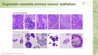 Investigating colorectal cancer using epithelial organoid cultures [upl. by Eaton695]