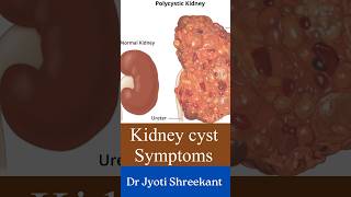 Kidney cyst symptoms shorts [upl. by Nellak]