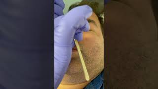 Professional male nose wax service with hard wax waxingexpert hairremoval [upl. by Brookner]