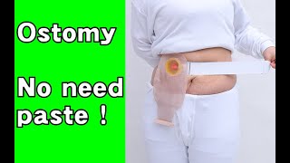 How to use two piece ostomy bag [upl. by Carley362]