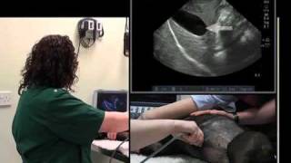 IMV imaging Abdominal Ultrasound Video 4  Ultrasound exam of the liver [upl. by Kass802]