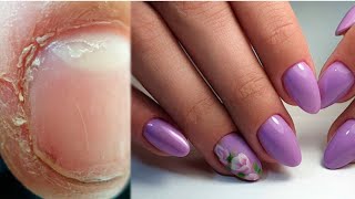 Huge Transformation On Stubby Nails  Snipping Off Cuticle With A Nail Drill 💅 [upl. by Arlin227]