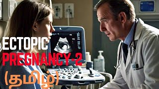 ectopicpregnancy part 2 gynecology clinical sign symptoms [upl. by Jenny836]