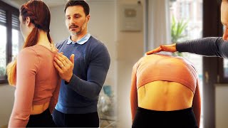 I Couldnt Believe the Transformation Before amp After a Scoliosis Treatment [upl. by Horne]