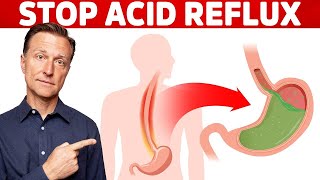 How to STOP Acid Reflux Instantly [upl. by Brod]