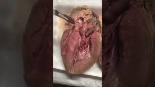 BIO169 Sheep Heart Dissection [upl. by Emirej]