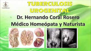 TUBERCULOSIS UROGENITAL GENITOURINARIA [upl. by Nedrah]