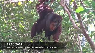 SelfTreatment of Facial Wound with Medicinal Plant by Sumatran Orangutan [upl. by Bucella]