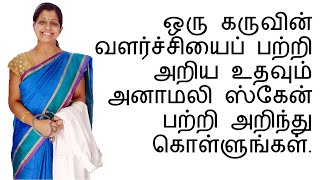 ஒரு கருவின் வளர்ச்சியைப் பற்றி அறிய உதவும் அனாமலி ஸ்கேன் பற்றி அறிந்து கொள்ளுங்கள் [upl. by Baiel]