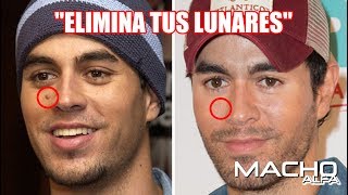 7 REMEDIOS CASEROS PARA ELIMINAR LOS LUNARES [upl. by Dylana]