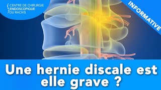 HERNIE DISCALE  Estelle grave [upl. by Tiersten409]