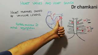 CVS physiology 231 Systolic murmur of mitral regurgitation  Heart valves  Heart sounds [upl. by Dier]