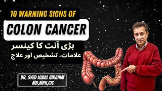 10 Warning Signs of Colon Cancer Symptoms Diagnosis amp Treatment [upl. by Rebeh]