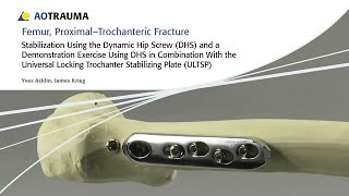 Femur Proximal – Trochanteric Fractures – Stabilization Using the Dynamic Hip Screw DHS with ULTSP [upl. by Inaluahek269]