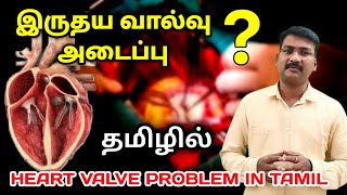 Heart Valve Problem in tamil  valvular heart disease aortic mitral  pulmonary tricuspid [upl. by Jacinthe191]