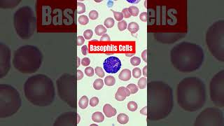 Basophils Cells  Blood smear slide microscopy Basophils bloodtest dmltlab viral trrndings [upl. by Naesal450]