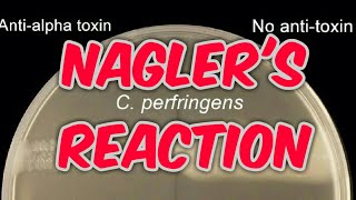 Naglers reaction clostridium perfringens in hindi [upl. by Bohs528]