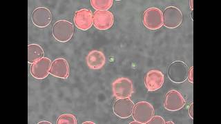 Babesia bovis merozoite egress from a red blood cell [upl. by Grobe277]