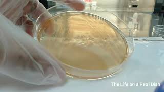 Oxidase Test for Pseudomonas [upl. by Moyer]