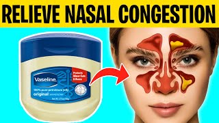 8 Ways To Naturally Relieve Nasal Congestion [upl. by Sholom401]