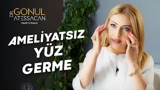 Ameliyatsız Yüz Germe Nedir Ameliyatsız Yüz Germe Yöntemleri [upl. by Noived]