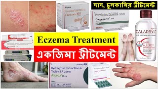 একজিমা ট্রীটমেন্ট Eczema Treatment Bong Pharma [upl. by Ojyma]