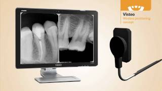 Owandy Visteo Digital Intra Oral Sensor [upl. by Eciral]