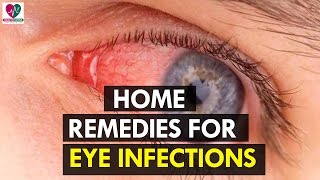 Home Remedies for Eye Infections  Health Sutra [upl. by Danelle685]