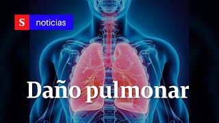 ¿Qué daño causa en los pulmones la covid19  Semana Tv [upl. by Marita444]