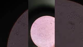 RBC Pus Cells and Bacteria in Urine  medicallabtechnologysajal6903 [upl. by Stella]